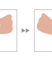 Invisible Push Up Bra - No Annoying Shoulder Straps.